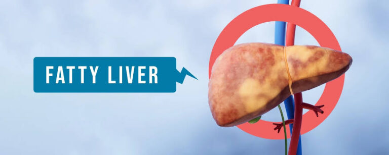 Best Fatty Liver Treatment in Indore