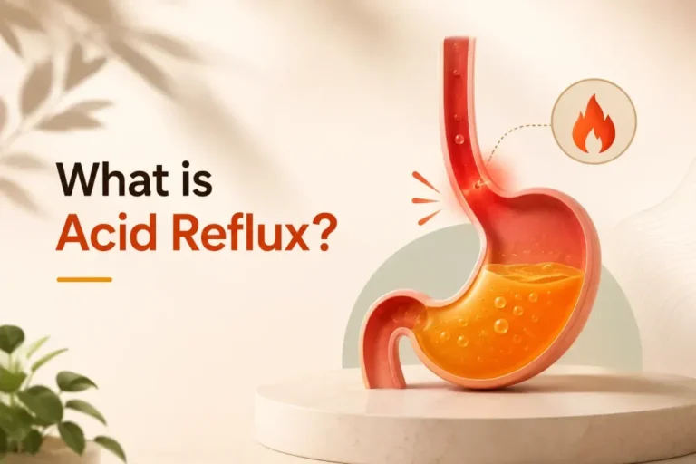 cred/ acid reflux /acidity symptoms and treatment